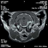 Neurology scan